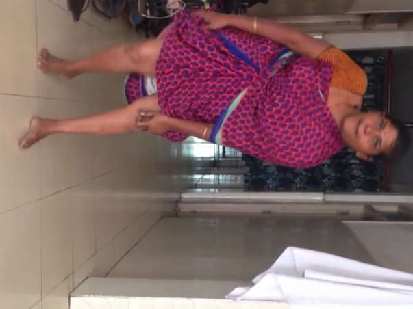 HELP KALA MARY FOR ARTIFICIAL LEG