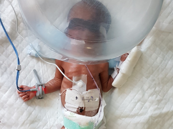 HELP MY NEW BORN PRE MATURE BABY WHO IS IN NICU