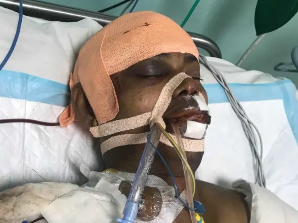 Bobby is looking to support his brain surgery bills