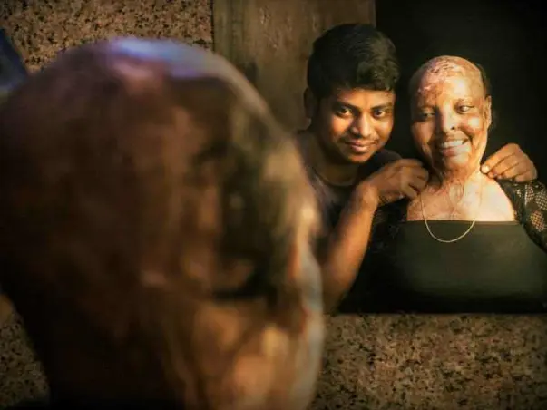 In the name of love for acid attack survivor Rani