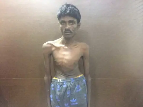 This 20-year-old Man Hasn't Slept For Years Because Of His Bent Spine