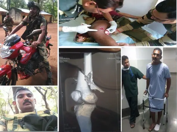 My Frnd Veeru a BSF Constable Injured Badly in Gun Battle with naxals