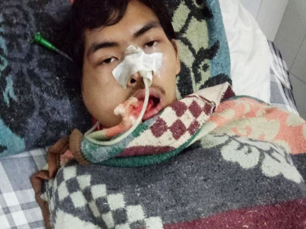 Help Rahendra to fight against Angiosarcoma