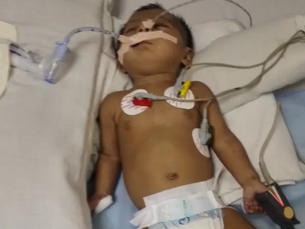 Extend your support for Amara to cure her critical pneumonia with PDA