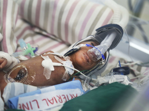 Petrol Pump Worker Races To Save 3Months Premature Born Twin Daughters