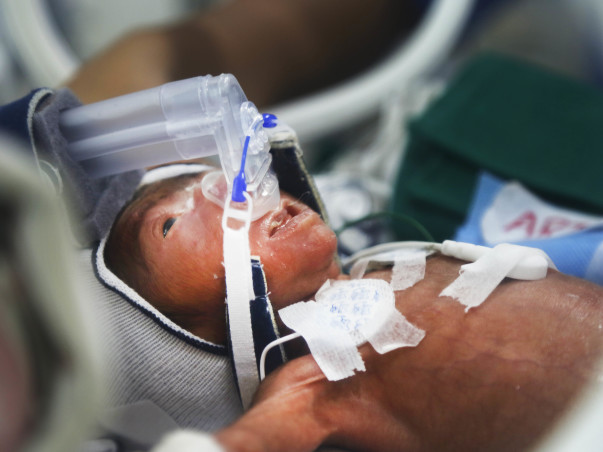 Petrol Pump Worker Races To Save 3Months Premature Born Twin Daughters