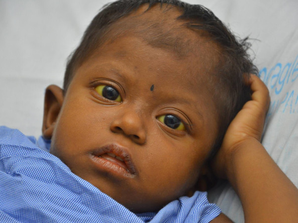 Help 4-Year-Old Who Scratches Skin and Pulls Hair Out In Pain
