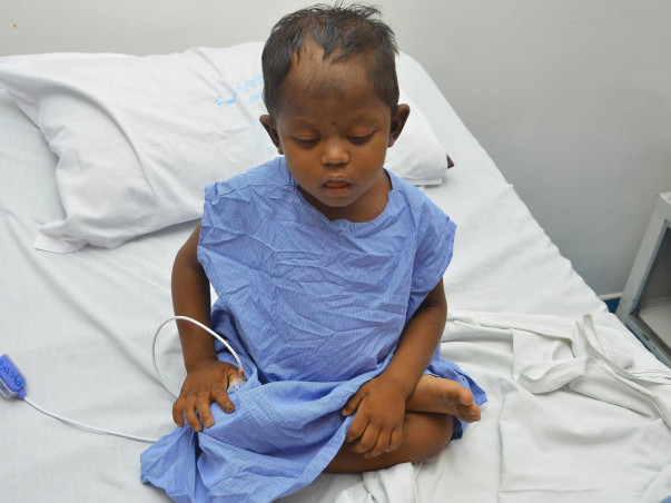 Help 4-Year-Old Who Scratches Skin and Pulls Hair Out In Pain