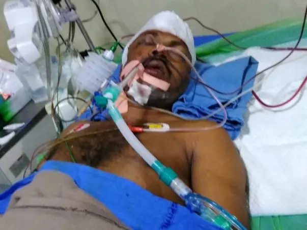 Help My Brother Who Is Undergoing For Brain Treatment