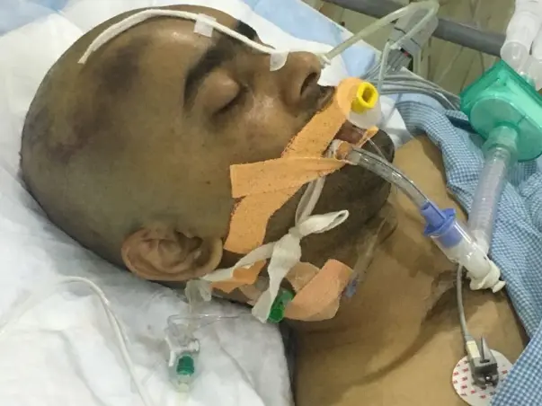 Please Help Our Friend Prashant Who Is Pushing His Limits To Survive