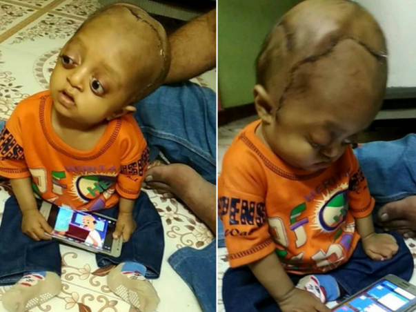 Help Ibrahim Lead A Normal Life
