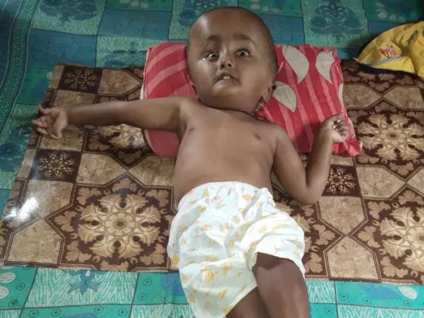 Help Aryan Fight Hydrocephalus