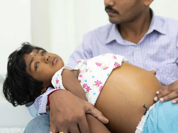 3-year-old's Stomach Is Swollen To The Size Of A Football