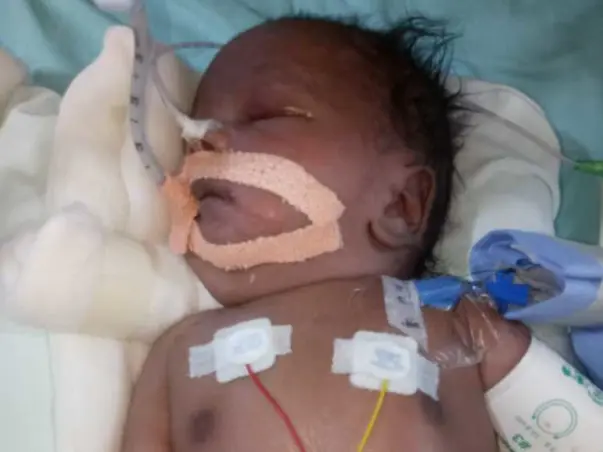 Help Baby of Riddhi Survive.