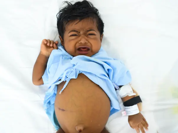 Help 6-Month-Old Abhinand Undergo Liver Transplant