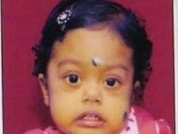 Help Baby Aaradhya  to undergo Liver transplant surgery