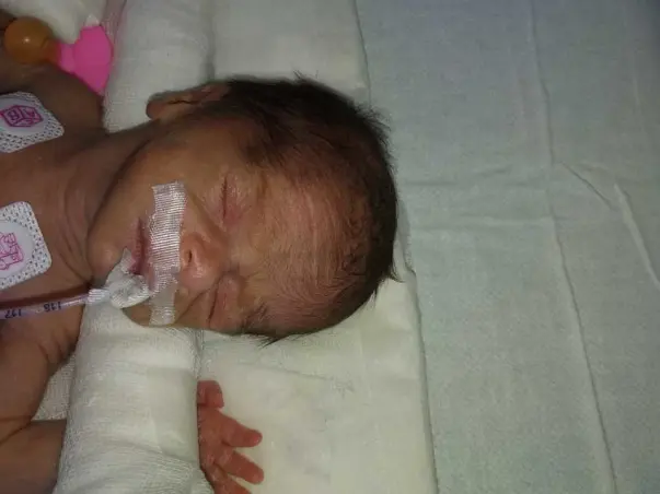 Need help!! To save ur little angles twins  in critical condition