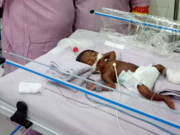 Help Preterm Baby Born At 25 Weeks