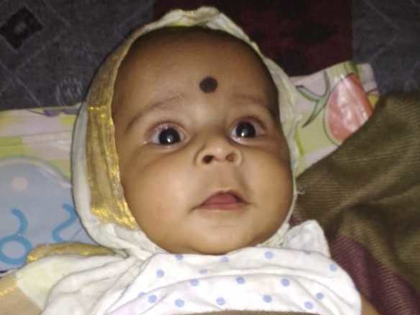 Help 5-month-old Baby Undergo Cataract Surgery A Heart Surgery