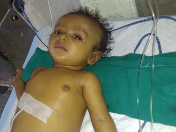Help to Mr. Siddaraju’ s 7 months old baby girl