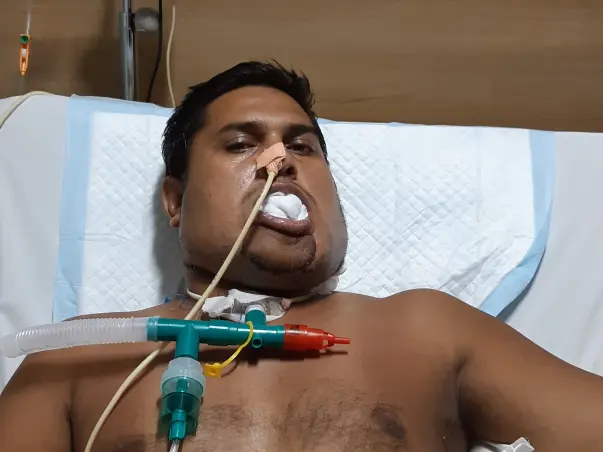 Help Rajendra Fight Mouth Cancer