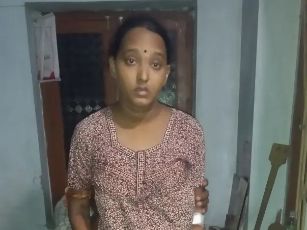 Help My Sister Undergo Kidney Transplant
