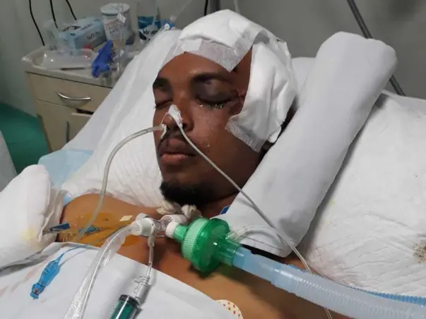 Help javeeth Hussain,  he met with an accident,  severe brain injury and now I  critical stage