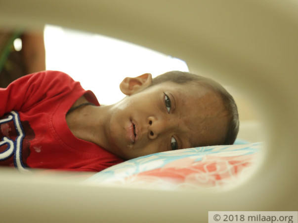 Without Urgent Treatment, 3-Year-Old Sathvik Will Lose His Vision