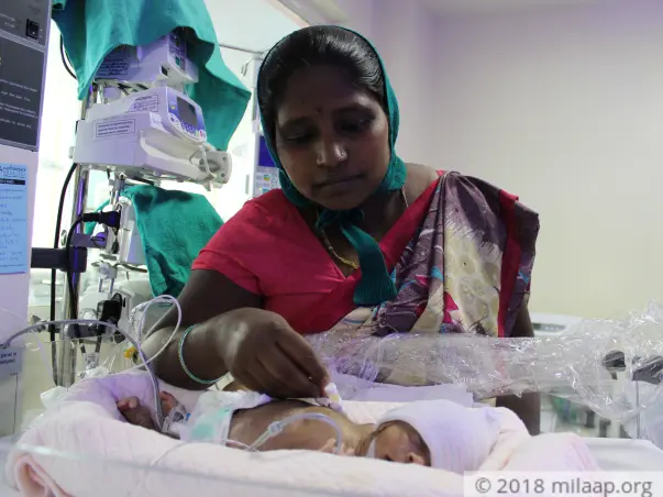 Helpless Mother Is Struggling To Save Premature Baby Born