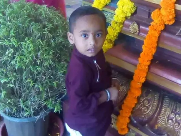 HELP THREE YEAR OLD PRANAY RECOVER FROM BURNS