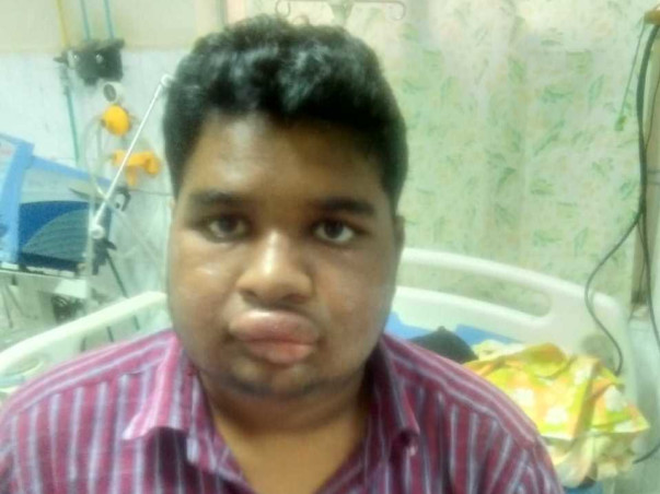 Help Rajesh Undergo A Bone Marrow Transplant