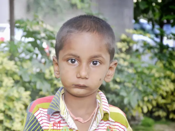 Auto Driver's 4-Year-Old Who Can't Even Open His Mouth Needs Surgery