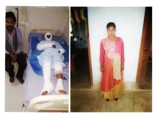 Help Burn Survivor Pratima Get Married