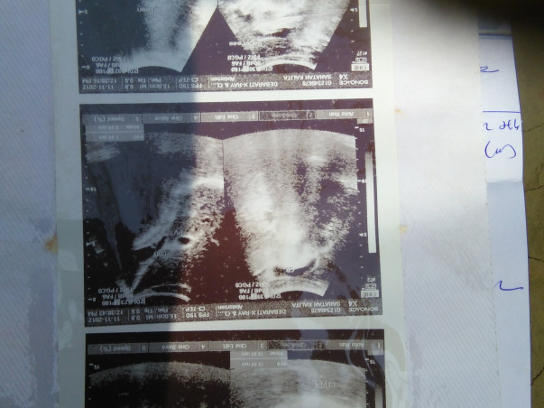Kindly Help me Raise Funds for my Medical Treatments.