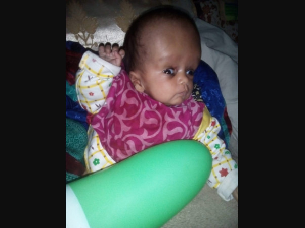 Help My Baby Girl Undergo Brain Operation