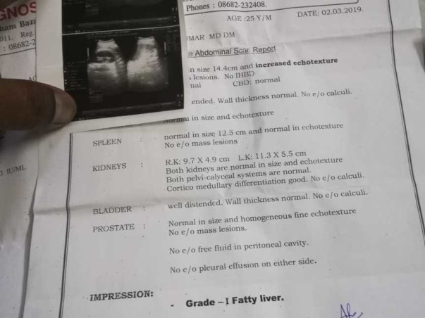 Help Me To Get Treated For Liver Treatment