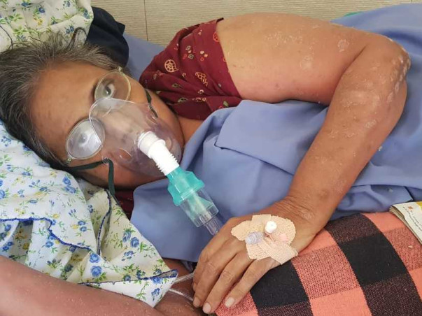 Help Balkis Begum Recover From A Rare Disease