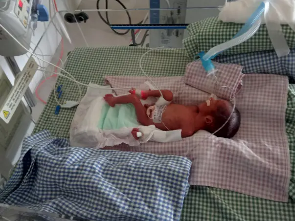 Help Karthikeyan To Save His Twin Babies