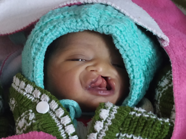 Help Little Tanvi, Kindly Donate And Help