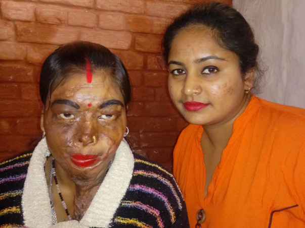 Help For Acid Survivors Cafe