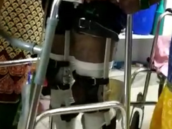 Help me treated for Spinal cord injury