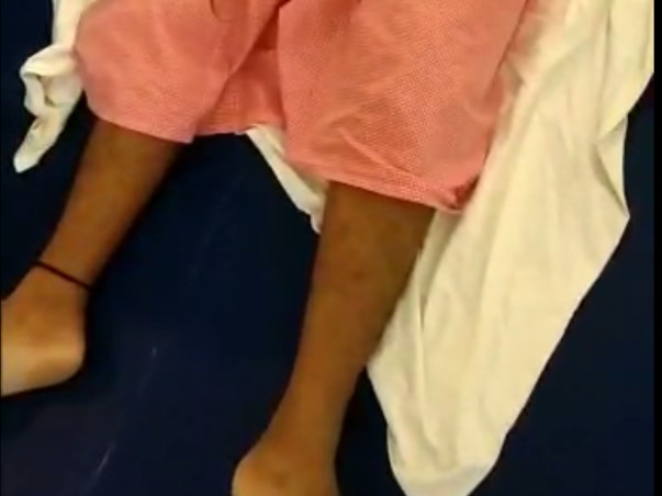 Help me treated for Spinal cord injury