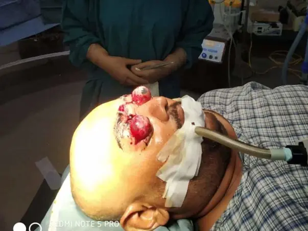 Support Anup Roy To Recover