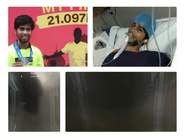 Support Yogesh to recover from accident