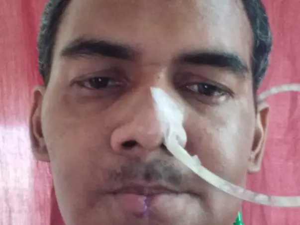 Support Adv. UMA SHANKAR fight mouth cancer.
