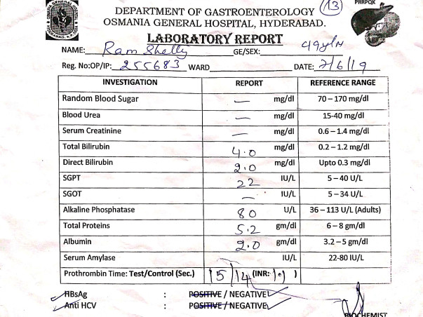 LIVER transplant