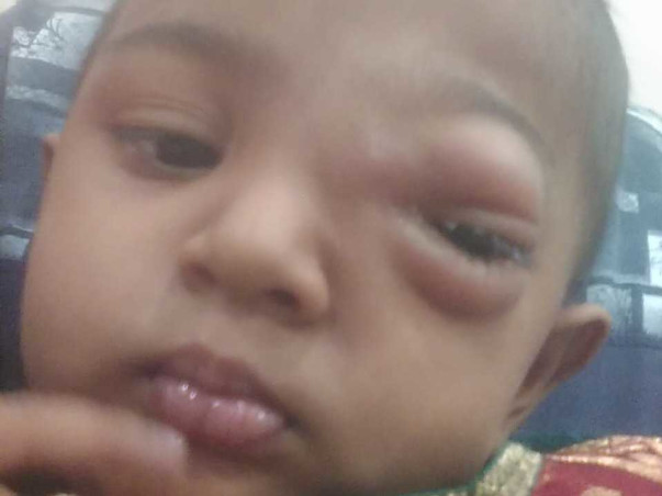 Help My Daughter Haleema Fight Cancer