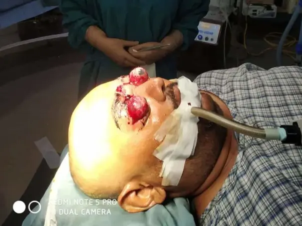 Anup needs your help