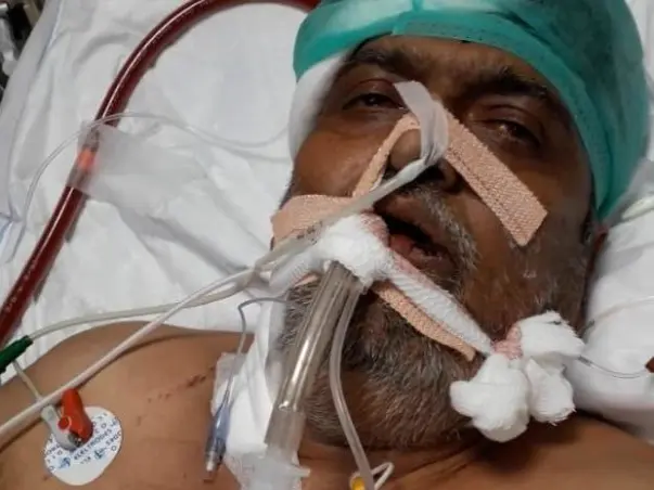 Help My Uncle Undergo A Lung Transplant