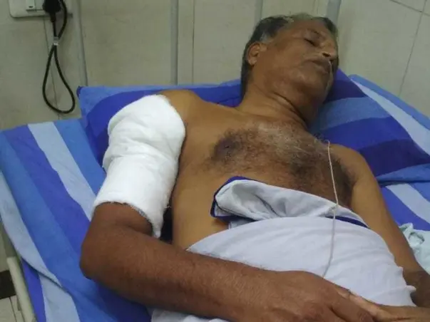 Help My Uncle Undergo Reduction Surgery.